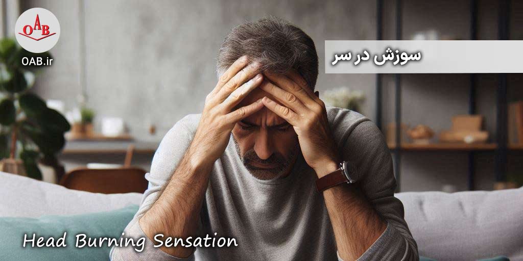 سوزش-در-سر-OAB